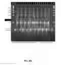 Fig. 08 - MICROARRAY SYSTEM WITH IMPROVED SEQUENCE SPECIFICITY