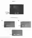 Fig. 08 - CANDIDA ALBICANS OLIGONUCLEOTIDES, DETECTION METHOD, AND KIT THEREOF