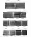 Fig. 03 - CANDIDA PARAPSILOSIS  OLIGONUCLEOTIDES, DETECTION METHOD, AND KIT THEREOF