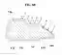 Fig. 09 - Partial heat treatment method in salt bath at low temperature