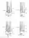 Fig. 35 - Locking and pivoting latch for a fence support post