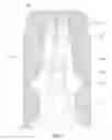Fig. 07 - Method and apparatus for achieving high power flame jets while reducing quenching and autoignition in prechamber spark plugs for gas engines