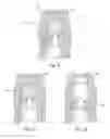 Fig. 08 - Method and apparatus for achieving high power flame jets while reducing quenching and autoignition in prechamber spark plugs for gas engines