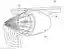 Fig. 01 - Bird strike prevention device for jet engine, and airplane incorporating the same