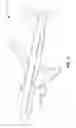 Fig. 02 - Bleed air systems for use with aircrafts and related methods