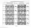 Fig. 07 - Earth bolt containing surface treatment layer and method of surface treatment of earth bolt