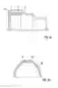 Fig. 03 - Planetary gear mechanism with adjustable ring gear