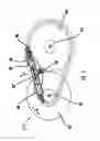 Fig. 02 - Guide device for an endless torque-transmitting means of a belt-driven conical-pulley transmission