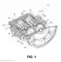 Fig. 02 - Efficiency Spur Gear Set Housing