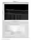 Fig. 10 - Methods for processing images generated using fourier domain optical coherence tomography (FDOCT)