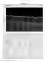 Fig. 11 - Methods for processing images generated using fourier domain optical coherence tomography (FDOCT)