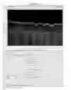Fig. 13 - Methods for processing images generated using fourier domain optical coherence tomography (FDOCT)