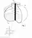 Fig. 02 - Guided wave radar level gauging with probe retaining element