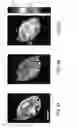 Fig. 06 - Distribution of refractive index measurement by synthetic aperture tomography