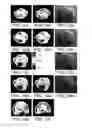 Fig. 15 - Distribution of refractive index measurement by synthetic aperture tomography