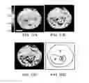 Fig. 18 - Distribution of refractive index measurement by synthetic aperture tomography