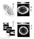 Fig. 23 - Distribution of refractive index measurement by synthetic aperture tomography