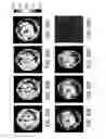 Fig. 24 - Distribution of refractive index measurement by synthetic aperture tomography