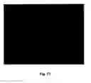 Fig. 11 - Biological Fluid Analysis System and Method