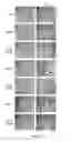 Fig. 09 - Methods and compounds for diagnosing threonyl-tRNA synthetase-associated diseases and conditions
