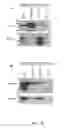 Fig. 16 - Methods and compounds for diagnosing threonyl-tRNA synthetase-associated diseases and conditions