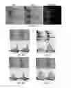 Fig. 02 - Methods and kits for diagnosing obstructive sleep apnea