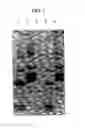 Fig. 02 - Monoclonal antibody against D-dimer and methods of use therefor