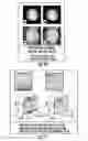 Fig. 11 - Magnetic resonance imaging systems for integrated parallel reception, excitation and shimming and related methods and devices