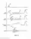 Fig. 06 - Method for magnetic resonance imaging with controlled aliasing