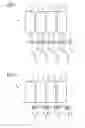 Fig. 02 - X-ray detector