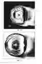 Fig. 08 - OPTICAL FIBER CLEAVING MECHANISM AND METHOD OF USE