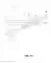 Fig. 11 - Imaging lens