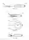 Fig. 08 - Sleeve and glove keeper watch bracket