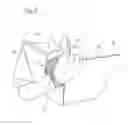Fig. 04 - Strap and electronic device