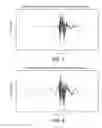 Fig. 07 - Adaptive quantization noise filtering of decoded audio data