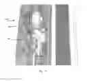 Fig. 22 - Switch actuation device