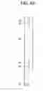 Fig. 07 - Safety shutter of vacuum circuit breaker