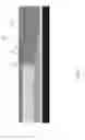 Fig. 17 - Multilevel contact to a 3D memory array and method of making thereof