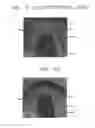 Fig. 06 - Semiconductor device and method of fabricating the same