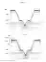Fig. 04 - Electrode contacts