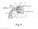 Fig. 08 - Adjusting device for an electric motor