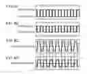 Fig. 07 - Electric power converter