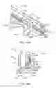 Fig. 35 - Photovoltaic array mounting apparatus, systems, and methods
