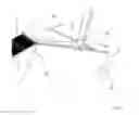 Fig. 06 - Device for harvesting fruit hanging from a plant as well as a method for harvesting fruit hanging from a plant