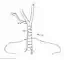 Fig. 01 - TREE GUARD