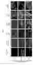 Fig. 06 - RECOMBINANT ALSV FOR PREVENTING PATHOGENIC VIRAL INFECTION OF PLANT