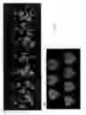 Fig. 28 - RECOMBINANT ALSV FOR PREVENTING PATHOGENIC VIRAL INFECTION OF PLANT