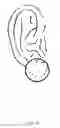 Fig. 15 - Ear protection device for athletes