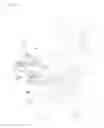 Fig. 03 - Articulation type supporter