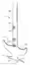 Fig. 01 - Handheld tool for removing matter from crevices